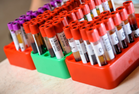 Etiquetas Tubos | Godex Mexico